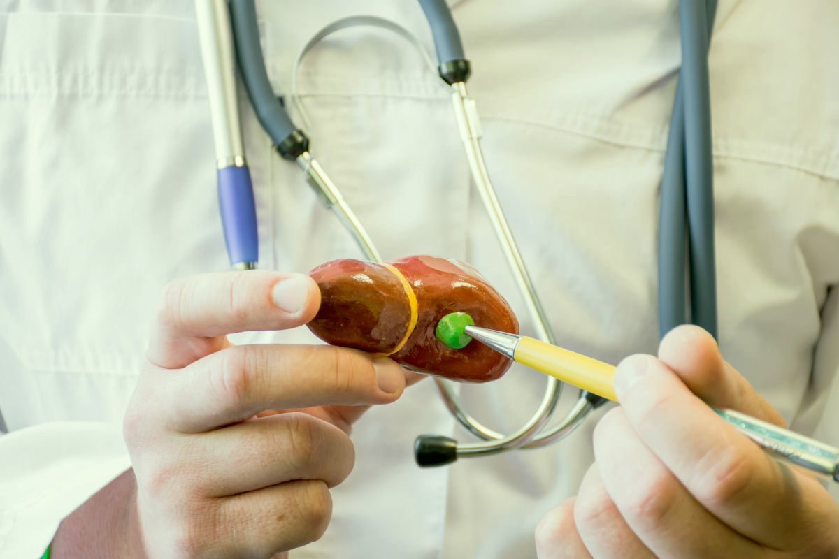 Ácido Quenodesoxicólico (Chenodal/Xenbilox): Importante aliado no tratamento da litíase biliar e outras condições hepáticas